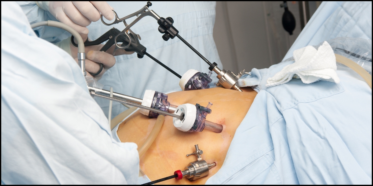 How Bariatric Surgery Works - Healix Hospitals